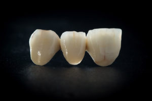 Imagine din Laboratorul de tehnica dentara Tonylab din Cluj-Napoca